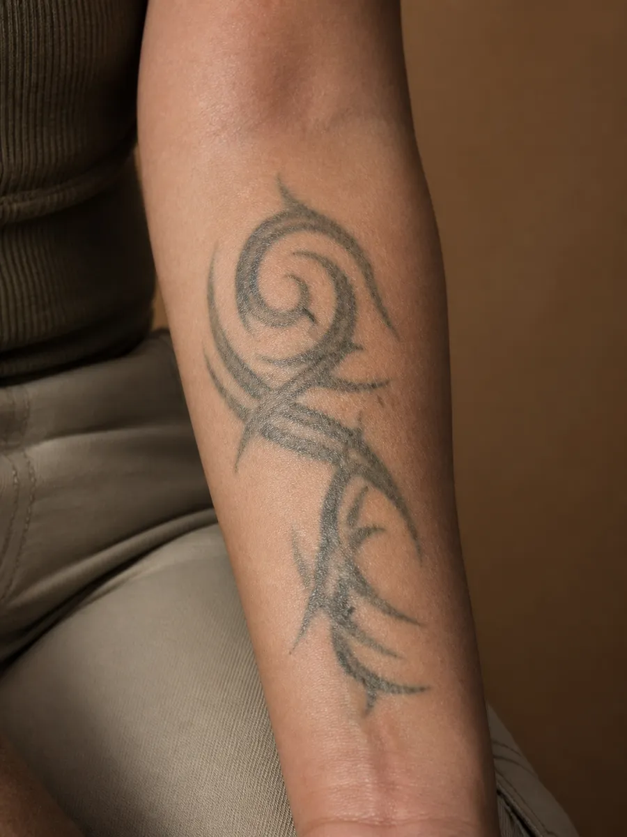 Un vieux tatouage tribal, aux traits estompés par le temps, sur l’avant-bras d’une femme, Clinique DC à Sainte-Rose, Laval
