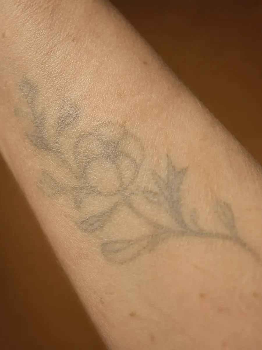 Avant-bras avec un tatouage de feuillage gris pâle, à moitié estompé, sous une lumière chaude, à Sainte-Rose, Laval