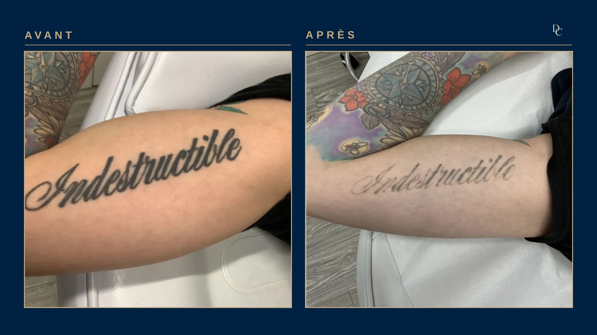 Forearm: the word “Indestructible” in thick black lettering, then the same word turned light grey; the neighbouring colour sleeve is untreated.